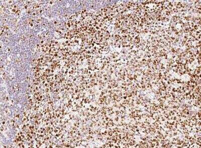 Immunohistochemistry-Paraffin: MSH6 Antibody (021) [NBP2-89318]