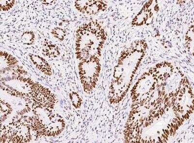 Immunohistochemistry-Paraffin: MSH6 Antibody (021) [NBP2-89318]