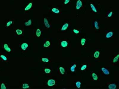 Immunocytochemistry/ Immunofluorescence: MSH6 Antibody (035) [NBP2-89265]