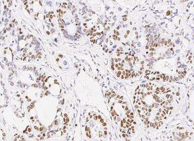 Immunohistochemistry-Paraffin: MSH6 Antibody (035) [NBP2-89265]