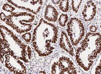 Immunohistochemistry-Paraffin: MSH6 Antibody (035) [NBP2-89265]