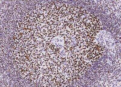 Immunohistochemistry-Paraffin: MSH6 Antibody (035) [NBP2-89265]