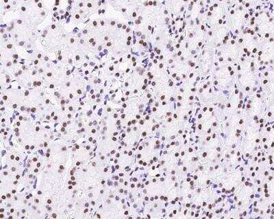 Immunohistochemistry-Paraffin: MSH6 Antibody (035) [NBP2-89265]
