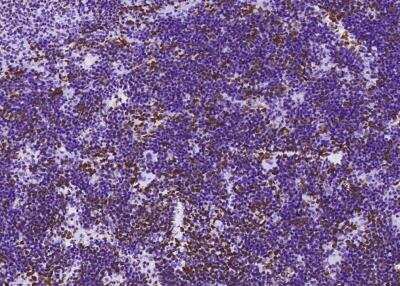 Immunohistochemistry-Paraffin: MSH6 Antibody (035) [NBP2-89265]