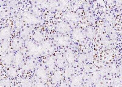 Immunohistochemistry-Paraffin: MSH6 Antibody (035) [NBP2-89265]