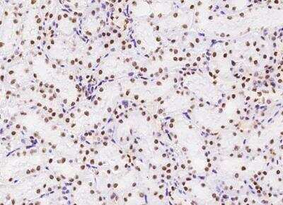 Immunohistochemistry-Paraffin: MSH6 Antibody (035) [NBP2-89265]