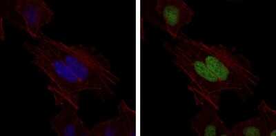Immunocytochemistry/ Immunofluorescence: MSH6 Antibody (3E1) - BSA Free [NBP2-37537]