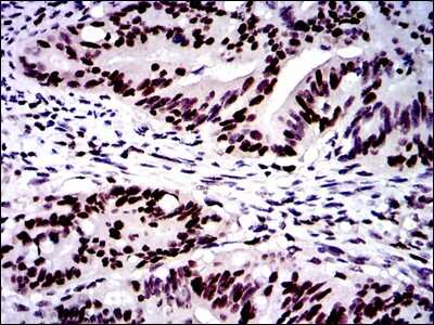 Immunohistochemistry-Paraffin: MSH6 Antibody (3E1) - BSA Free [NBP2-37537]