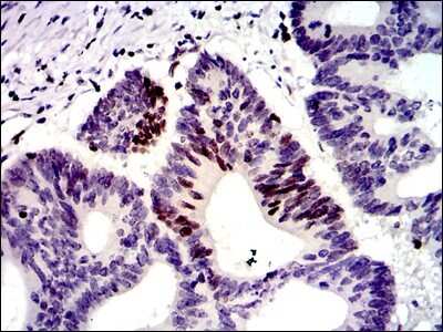 Immunohistochemistry-Paraffin: MSH6 Antibody (3E1) - BSA Free [NBP2-37537]