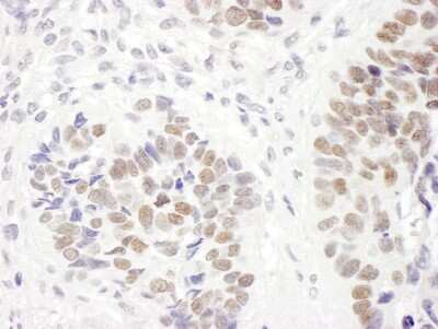 Immunohistochemistry-Paraffin: MSH6 Antibody [NB100-328]