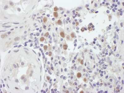 Immunohistochemistry-Paraffin: MSH6 Antibody [NB100-329]