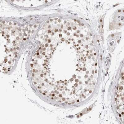 Immunohistochemistry-Paraffin: MSH6 Antibody [NBP1-83318]