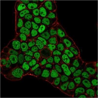 Immunocytochemistry/ Immunofluorescence: MSH6 Antibody (MSH6/3086) - Azide and BSA Free [NBP2-79846]