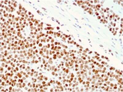 Immunohistochemistry-Paraffin: MSH6 Antibody (MSH6/3086) - Azide and BSA Free [NBP2-79846]