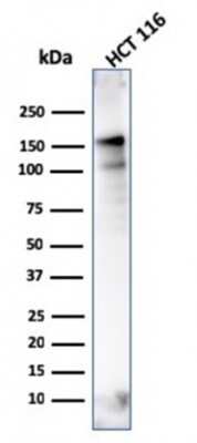 Western Blot: MSH6 Antibody (MSH6/3086)Azide and BSA Free [NBP2-79846]