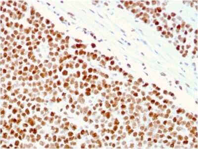 Immunohistochemistry-Paraffin: MSH6 Antibody (MSH6/3086) [NBP2-79712]
