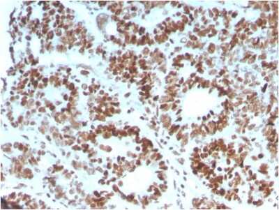 Immunohistochemistry-Paraffin: MSH6 Antibody (MSH6/3086) [NBP2-79712]