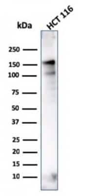 Western Blot: MSH6 Antibody (MSH6/3086) [NBP2-79712]