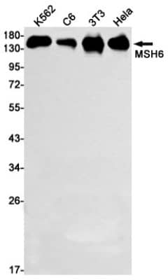 Western Blot: MSH6 Antibody (S05-2B5) [NBP3-19526]