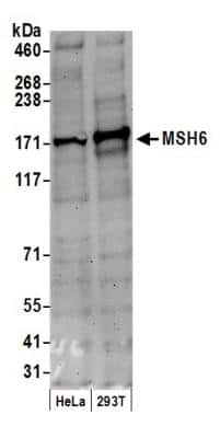 Western Blot: MSH6 Antibody [NB100-328]