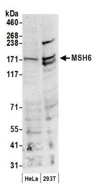 Western Blot: MSH6 Antibody [NB100-329]