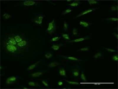 Immunocytochemistry/ Immunofluorescence: MSK1/RPS6KA5 Antibody (1G7) [H00009252-M11]