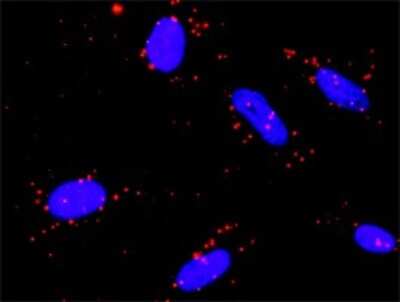 Proximity Ligation Assay: MSK1/RPS6KA5 Antibody (2B11) [H00009252-M01]