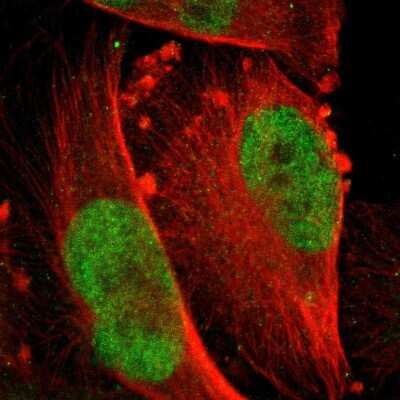 Immunocytochemistry/ Immunofluorescence: MSK1/RPS6KA5 Antibody [NBP2-55624]