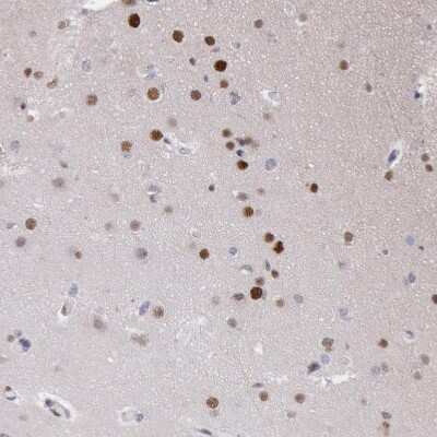 Immunohistochemistry-Paraffin: MSK1/RPS6KA5 Antibody [NBP1-82618]