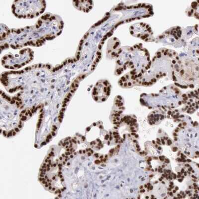 Immunohistochemistry-Paraffin: MSK1/RPS6KA5 Antibody [NBP1-82618]
