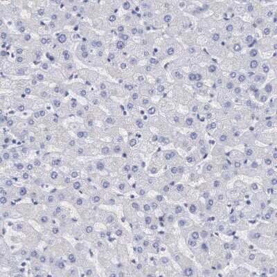 Immunohistochemistry-Paraffin: MSK1/RPS6KA5 Antibody [NBP1-82618]