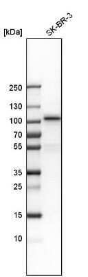 Western Blot: MSK1/RPS6KA5 Antibody [NBP1-82618]