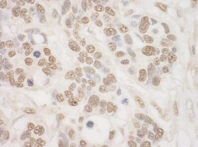 Immunohistochemistry-Paraffin: MSK2 Antibody [NBP1-46187]