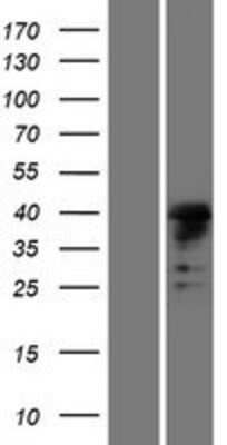 Western Blot: MSL1 Overexpression Lysate [NBP2-08789]