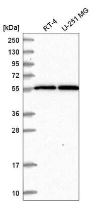 Western Blot: MSL2L1 Antibody [NBP2-55556]