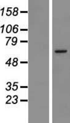 Western Blot: MSL2L1 Overexpression Lysate [NBL1-13330]