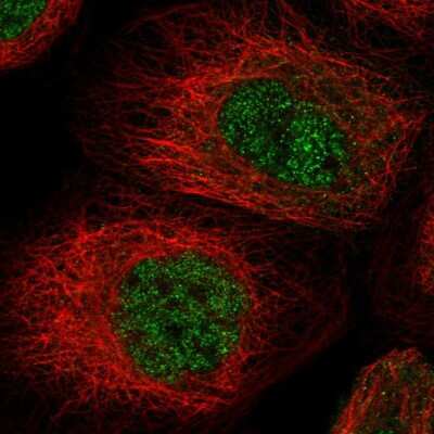 Immunocytochemistry/ Immunofluorescence: MSL3L1 Antibody [NBP1-87882]