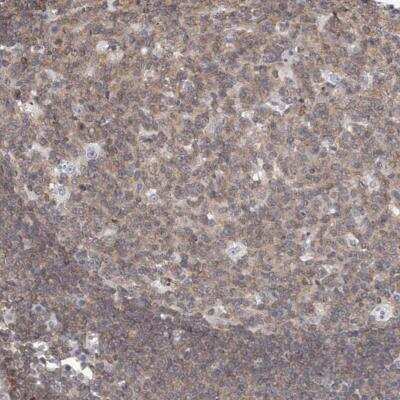 Immunohistochemistry-Paraffin: MSL3L1 Antibody [NBP1-87881]