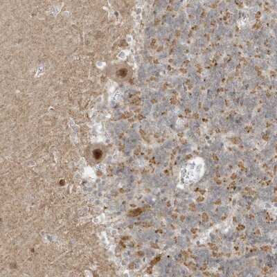 Immunohistochemistry-Paraffin: MSL3L1 Antibody [NBP1-87882]