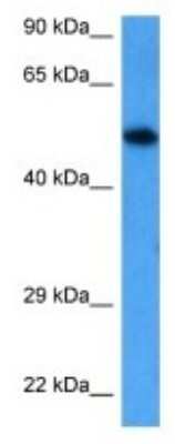 Western Blot: MSL3L1 Antibody [NBP3-09964]