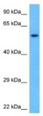 Western Blot: MSL3L1 Antibody [NBP3-10990]