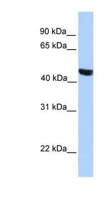 Western Blot: MSL3P1 Antibody [NBP1-91412]