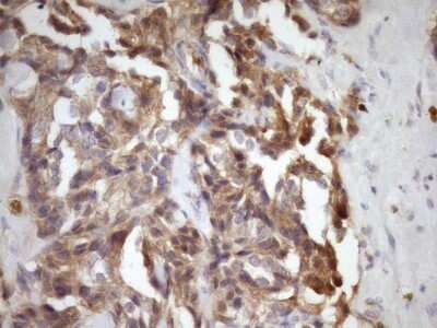 Immunohistochemistry-Paraffin: MSP/MST1 Antibody (OTI1A10) [NBP2-46024]