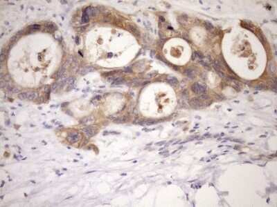 Immunohistochemistry-Paraffin: MSP/MST1 Antibody (OTI1A10) [NBP2-46024]
