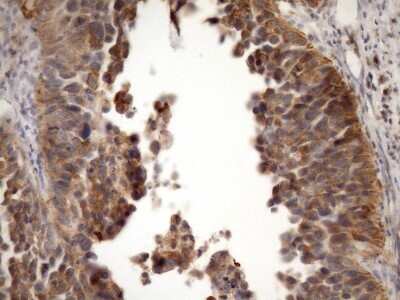 Immunohistochemistry-Paraffin: MSP/MST1 Antibody (OTI1A10) [NBP2-46024]