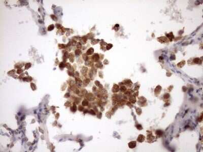 Immunohistochemistry-Paraffin: MSP/MST1 Antibody (OTI1A10) [NBP2-46024]