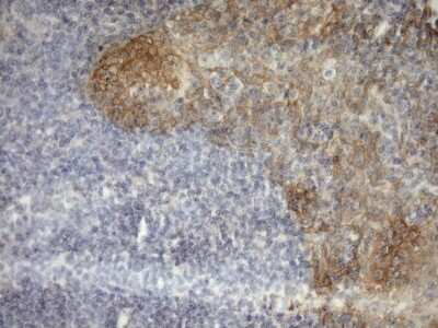 Immunohistochemistry-Paraffin: MSP/MST1 Antibody (OTI1A10) [NBP2-46024]