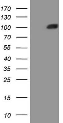 Western Blot: MSP/MST1 Antibody (OTI1A10) [NBP2-46024]