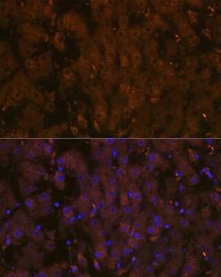 Immunohistochemistry: MSP/MST1 Antibody (5R7X2) [NBP3-15250]