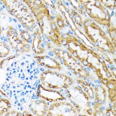 Immunohistochemistry-Paraffin: MSP/MST1 Antibody (5R7X2) [NBP3-15250]